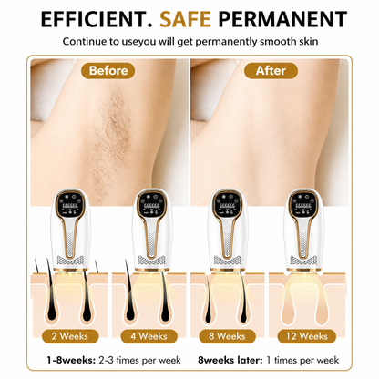 IPL Hair Removal TRILUX™